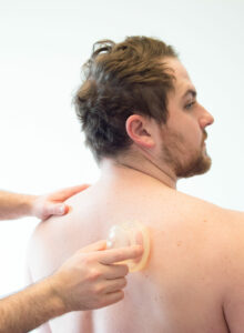 Dr. Mason Stewart, DC of New Leaf House Call Chiropractic in Post Falls, ID conducts cupping on the shoulder of a male patient.