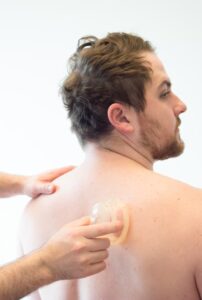 Dr. Mason Stewart, DC of New Leaf House Call Chiropractic in Post Falls, ID conducts cupping on the shoulder of a male patient.